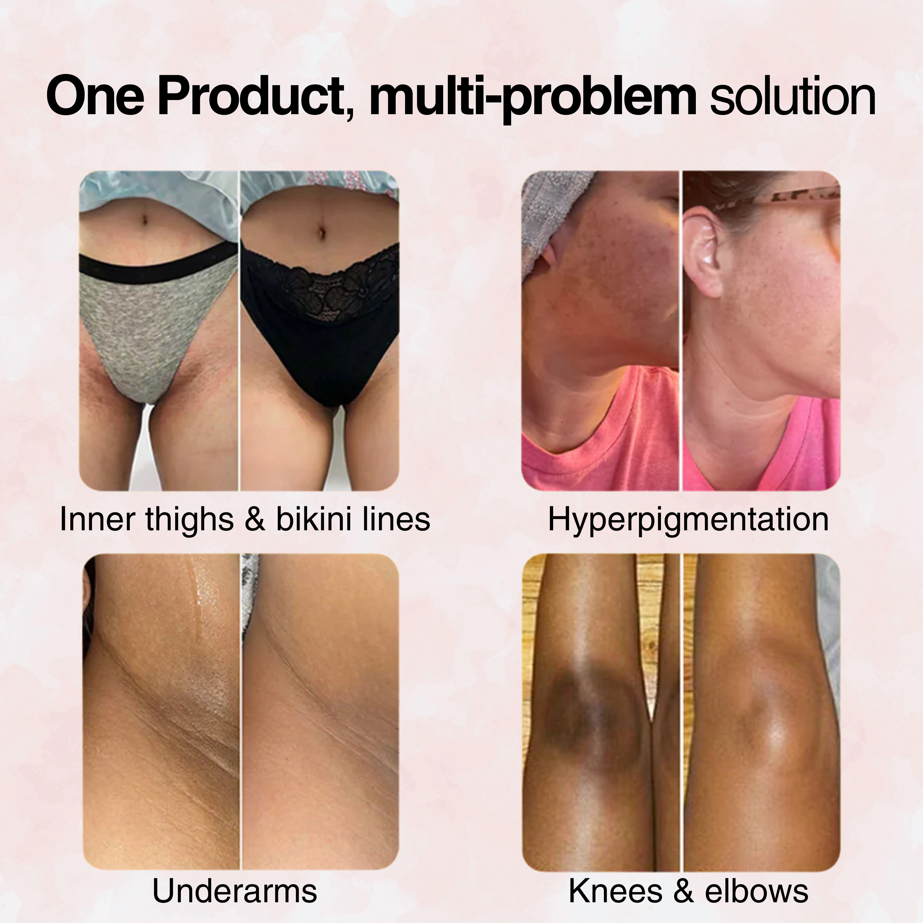 Supplement bottle promoting joint and bone health, with individuals holding it.