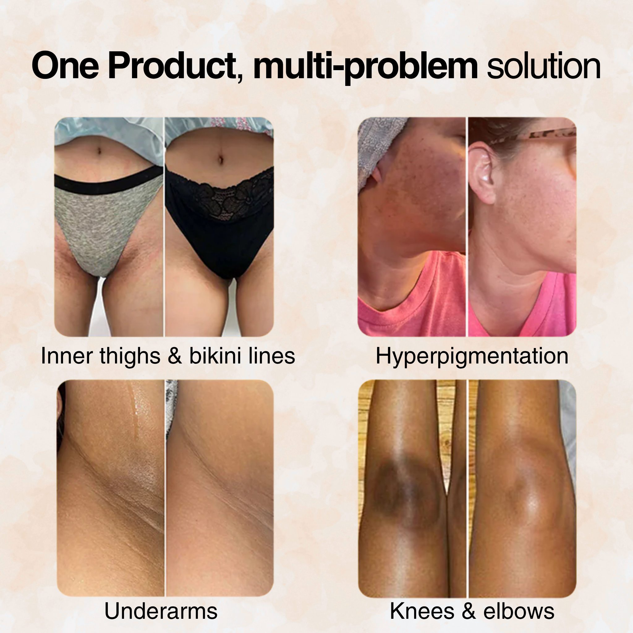 Supplement bottle promoting joint and bone health, with individuals holding it.