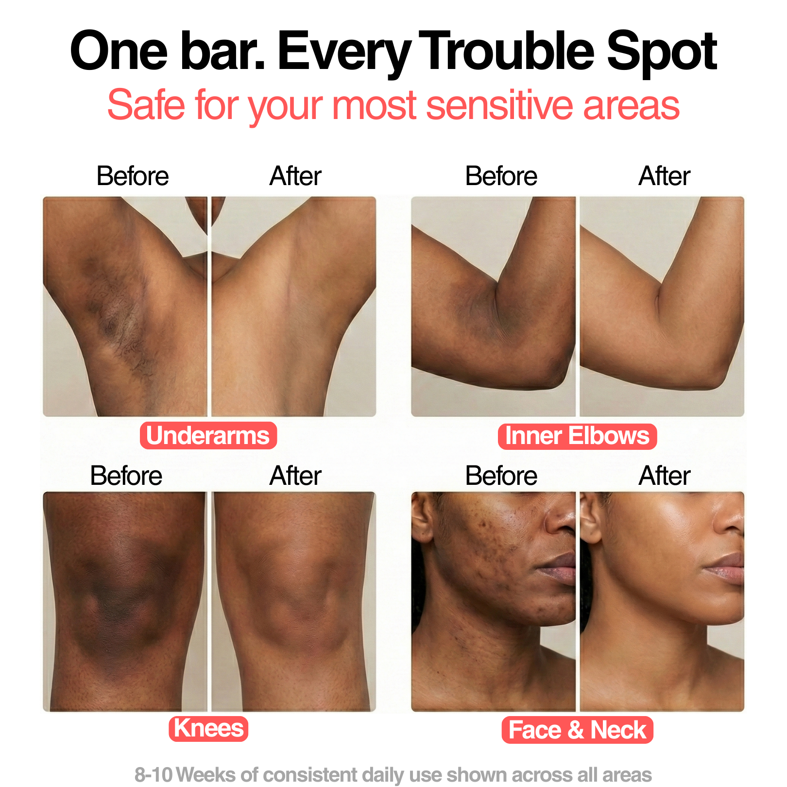 Supplement bottle promoting joint and bone health, with individuals holding it.