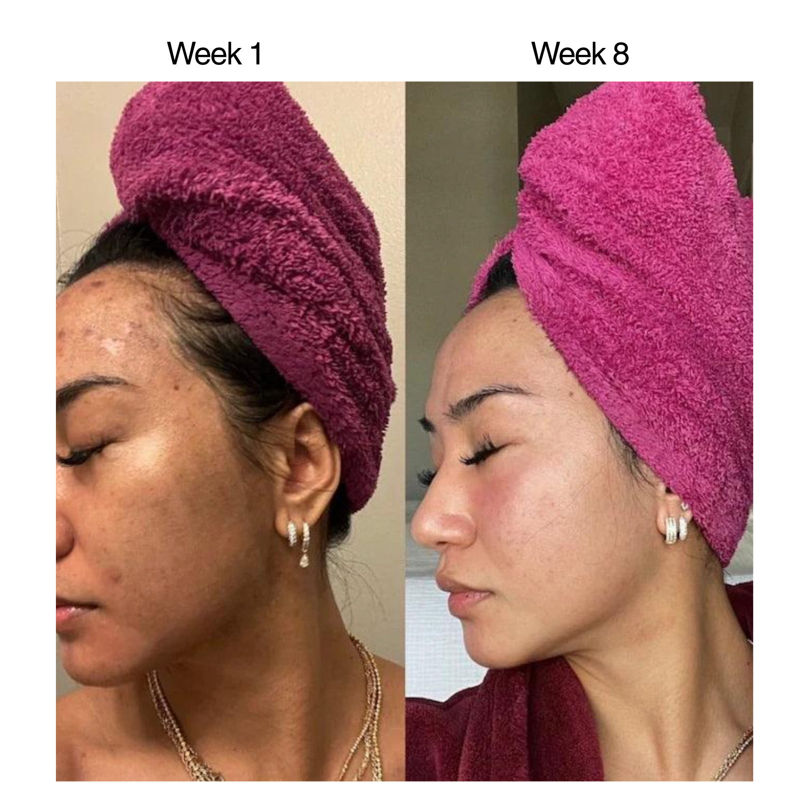 Supplement bottle promoting joint and bone health, with individuals holding it.